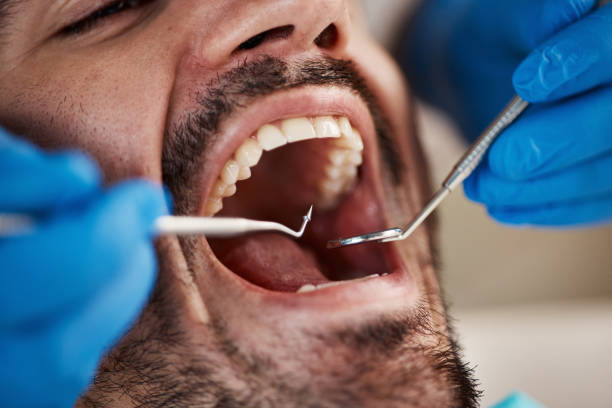 Best Pediatric Emergency Dentist in Slayton, MN